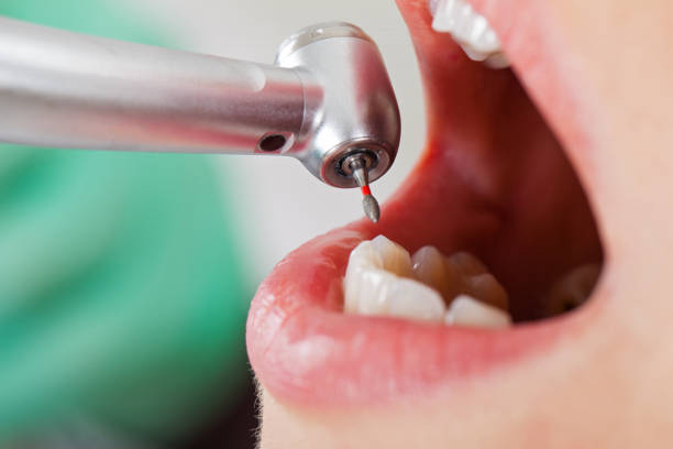 Best Dental Abscess Treatment in Hampton Manor, NY
